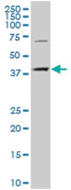 cytidine monophosphate (UMP-CMP) kinase 2, mitochondrial, Mouse, Polyclonal