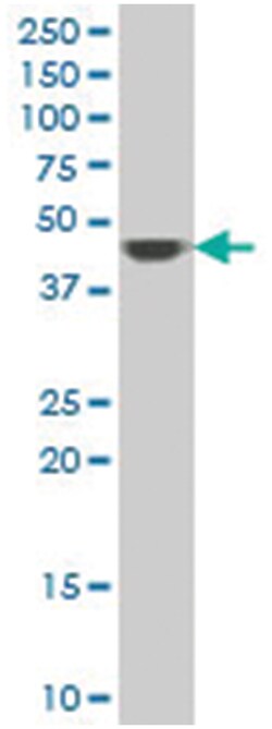 aminocarboxymuconate semialdehyde decarboxylase, Mouse, Polyclonal Antibody, Abnova 50 &mu;L | Buy Online | Abnova | Fisher Scientific