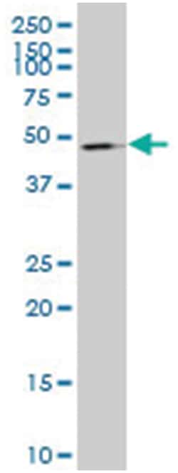 ubiquitin protein ligase E3 component n-recognin 3 (putative) (A01), Mouse