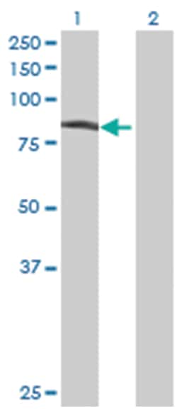ubiquitin protein ligase E3 component n-recognin 3 (putative) (B01), Mouse