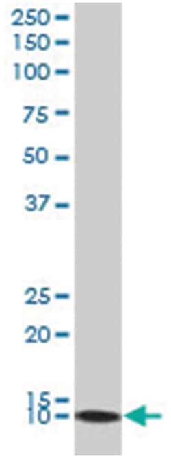 DnaJ (Hsp40) homolog, subfamily C, member 19, Mouse, Polyclonal Antibody, Abnova 50 &mu;L | Buy Online | Abnova | Fisher Scientific