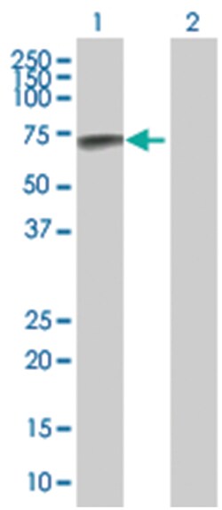 anti-GRK7, Polyclonal, Abnova 50 &mu;g | Buy Online | Abnova | Fisher Scientific