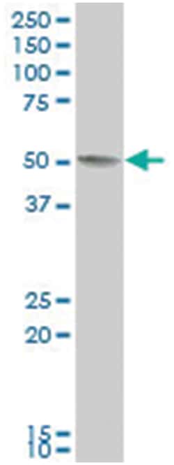 alcohol dehydrogenase, iron containing, 1, Mouse, Polyclonal Antibody,