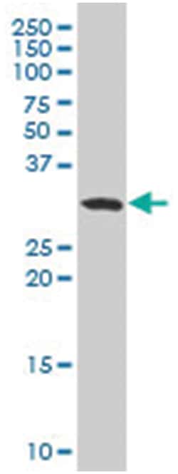 ankyrin repeat and SOCS box-containing 11, Mouse, Polyclonal Antibody,