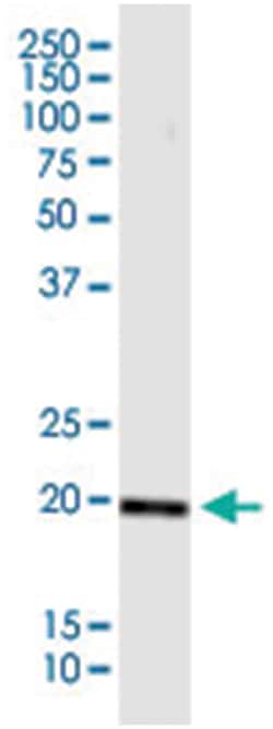 BRI3BP, Mouse, Clone: 3H1, Abnova 100&mu;g; Unlabeled:Antibodies, Monoclonal