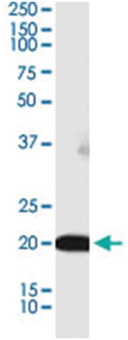 BRI3BP, Mouse, Clone: 3H1, Abnova 100&mu;g; Unlabeled:Antibodies, Monoclonal