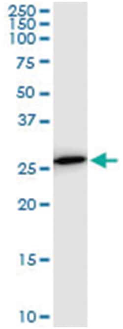 PSMA8, Mouse, Clone: 5A8, Abnova 200&mu;L; Unlabeled:Antibodies, Monoclonal