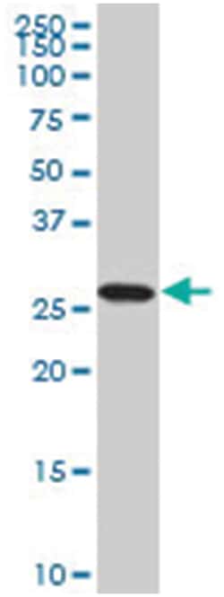 PSMA8, Mouse, Clone: 5A8, Abnova 200&mu;L; Unlabeled:Antibodies, Monoclonal