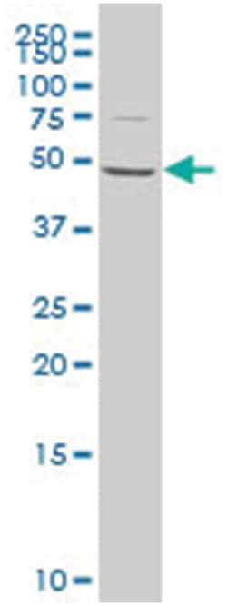 RAD9 homolog B (S. pombe), Mouse, Polyclonal Antibody, Abnova 50&mu;L;