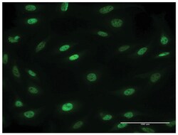 mesoderm posterior 2 homolog (mouse), Mouse, Clone: 1C8, Abnova 100&mu;g;