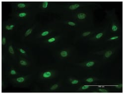 mesoderm posterior 2 homolog (mouse), Mouse, Clone: 1C8, Abnova 100&mu;g;