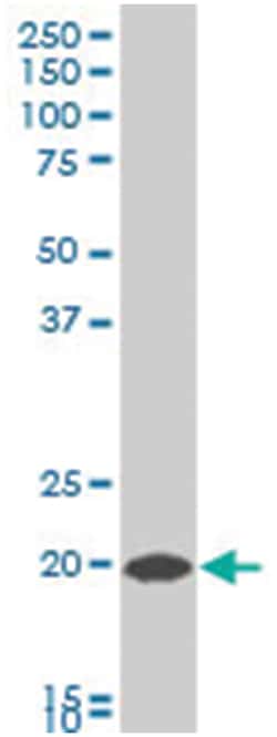 copper metabolism (Murr1) domain containing 1 (A01), Mouse anti-Human,