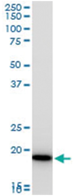 copper metabolism (Murr1) domain containing 1 (A01), Mouse anti-Human,