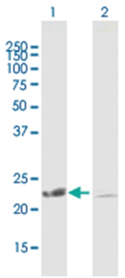 copper metabolism (Murr1) domain containing 1 (B01), Mouse anti-Human,