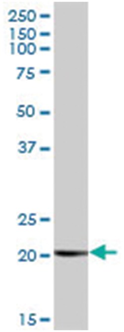 copper metabolism (Murr1) domain containing 1 (B01), Mouse anti-Human,