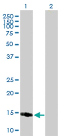 protein phosphatase 1, regulatory (inhibitor) subunit 1C, Mouse, Purified