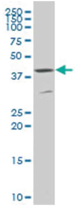 growth differentiation factor 7, Mouse, Polyclonal Antibody, Abnova 50&mu;L;