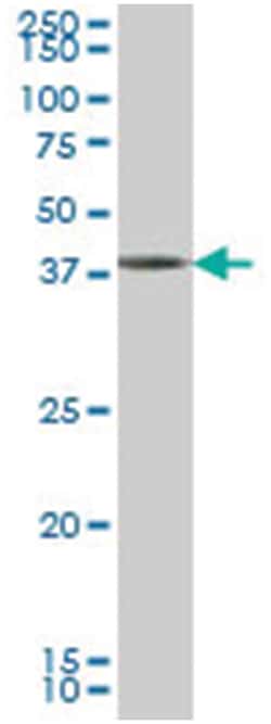 growth differentiation factor 7, Mouse, Clone: 3C2, Abnova 100&mu;g; Unlabeled:Antibodies