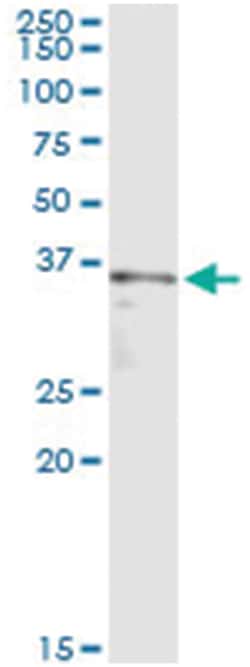 shugoshin-like 1 (S. pombe), Mouse, Clone: 4G6, Abnova 100&mu;g; Unlabeled:Antibodies,