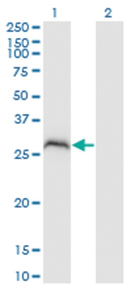protein phosphatase 1, regulatory (inhibitor) subunit 2 pseudogene 3, Mouse,