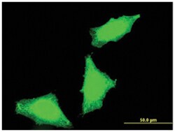 protein phosphatase 1, regulatory (inhibitor) subunit 2 pseudogene 3, Mouse,
