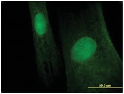 melanoma antigen family B, 6, Mouse, Polyclonal Antibody, Abnova 50&mu;L;