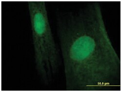 melanoma antigen family B, 6, Mouse, Polyclonal Antibody, Abnova 50&mu;L;