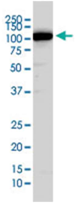 ubiquitin specific peptidase 51, Mouse, Polyclonal Antibody, Abnova 50&mu;L;