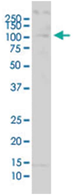 ubiquitin specific peptidase 51, Mouse, Polyclonal Antibody, Abnova 50&mu;L;