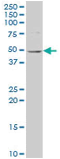 N-acetylglutamate synthase, Mouse, Polyclonal Antibody, Abnova 50&mu;L;