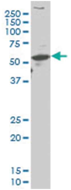 aristaless related homeobox, Mouse, Clone: 4A8, Abnova 100&mu;g; Unlabeled:Antibodies,