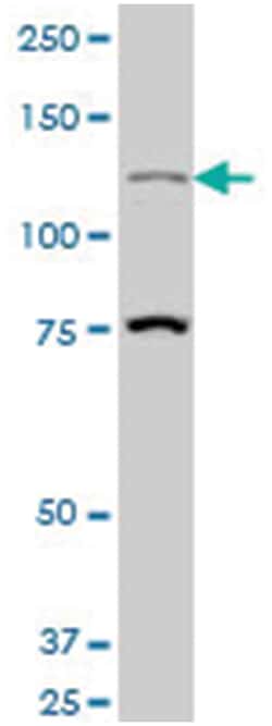 homeodomain interacting protein kinase 1, Mouse, Polyclonal Antibody, Abnova 50 &mu;L | Buy Online | Abnova Corporation | Fisher Scientific