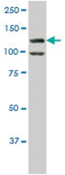 homeodomain interacting protein kinase 1, Mouse, Clone: 4E1, Abnova 100&mu;g;