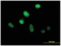 zinc finger protein 25, Mouse, Polyclonal Antibody, Abnova 50&mu;L; Unlabeled:Antibodies,