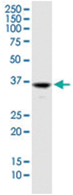 GLYATL2, Mouse, Clone: 1C5, Abnova 100&mu;g; Unlabeled:Antibodies, Monoclonal