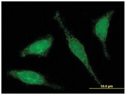 C6orf206, Mouse, Polyclonal Antibody, Abnova 50&mu;g; Unlabeled:Antibodies,