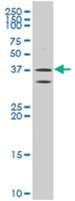 ATPase, H+ transporting, lysosomal, V0 subunit d2, Mouse, Polyclonal Antibody,