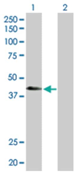 ATPase, H+ transporting, lysosomal 42kDa, V1 subunit C2, Rabbit, Purified