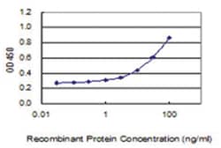 anti-WDR27, Clone: 3C5, Abnova 100 &mu;g | Buy Online | Abnova Corporation | Fisher Scientific