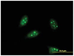 pancreas specific transcription factor, 1a, Mouse, Clone: 1A2, Abnova 100&mu;g;