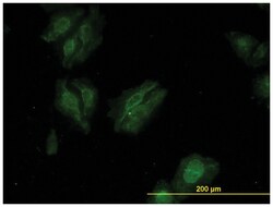 kinase suppressor of ras 2, Mouse, Clone: 6C9, Abnova 100&mu;g; Unlabeled:Antibodies,