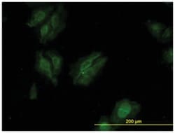 kinase suppressor of ras 2, Mouse, Clone: 6C9, Abnova 100&mu;g; Unlabeled:Antibodies,