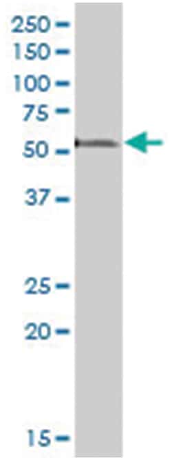 polymerase I and transcript release factor, Mouse, Polyclonal Antibody,