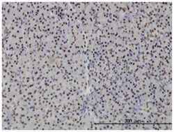 polymerase I and transcript release factor, Mouse, Clone: 1F7, Abnova 100&mu;g;