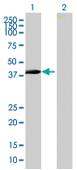 zinc finger protein 547, Mouse, Polyclonal Antibody, Abnova 50 &mu;L | Buy Online | Abnova Corporation | Fisher Scientific