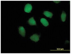 zinc finger protein 547, Mouse, Polyclonal Antibody, Abnova 50 &mu;L | Buy Online | Abnova Corporation | Fisher Scientific