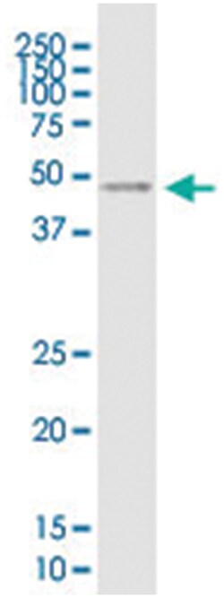 VSTM1, Mouse, Clone: 2E12, Abnova 100&mu;g; Unlabeled:Antibodies, Monoclonal