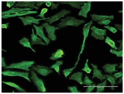 EMR4P, Mouse, Clone: 1G10, Abnova&trade;