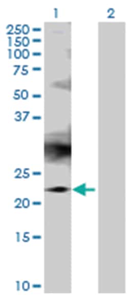 RAB7B, member RAS oncogene family, Mouse, Polyclonal Antibody, Abnova 50&mu;L;