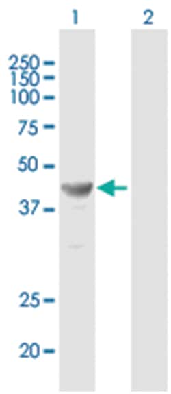 TFAP2E, Mouse, Polyclonal Antibody, Abnova 50 &mu;g | Buy Online | Abnova Corporation | Fisher Scientific